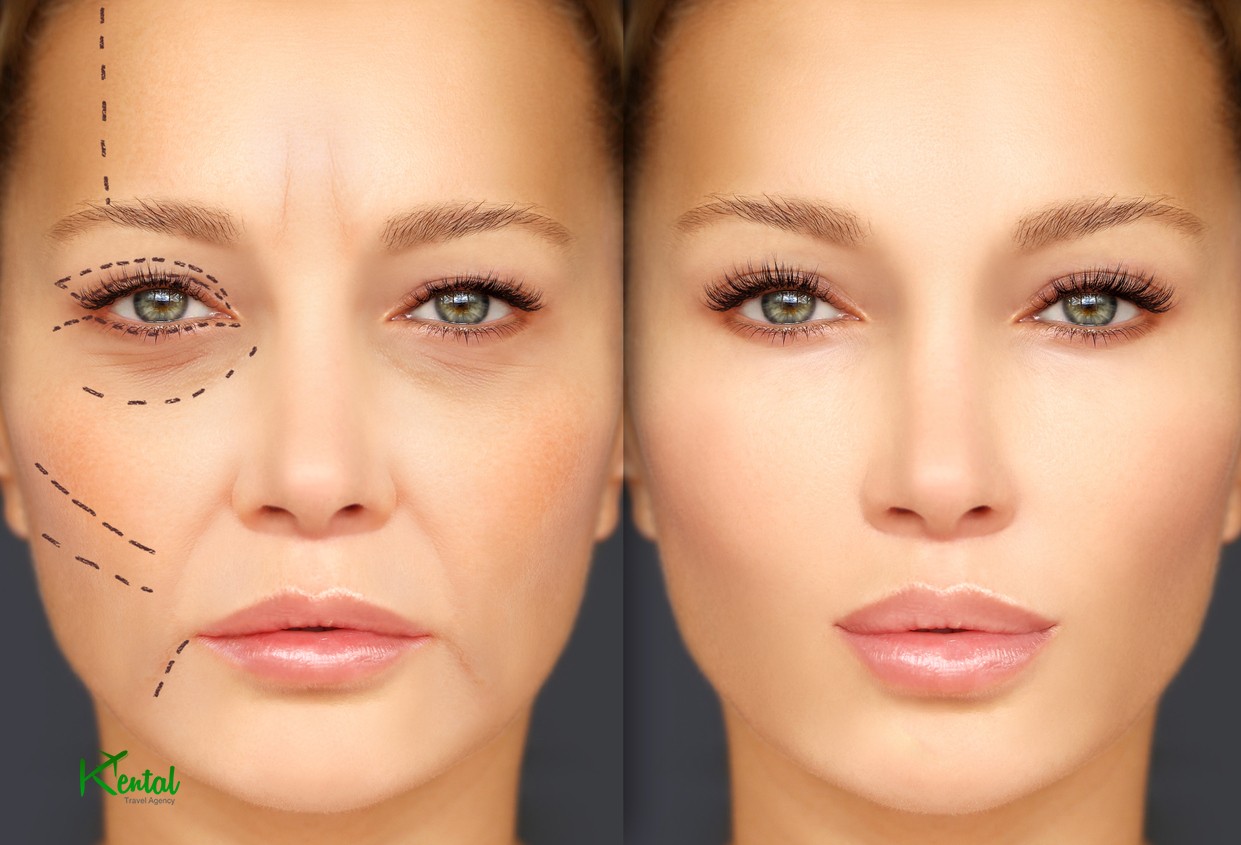 Best plastic surgery clinic in Iran